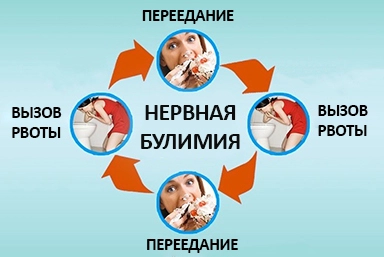 Лечение булимии в Городовиковске